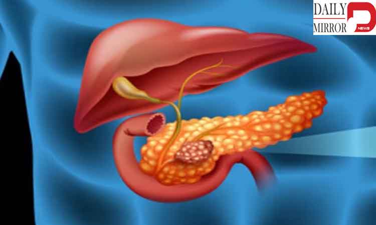 ప్యాంక్రియాటిక్ క్యాన్సర్: భారత్‌లో బ్రతికే అవకాశం కేవలం 3%..